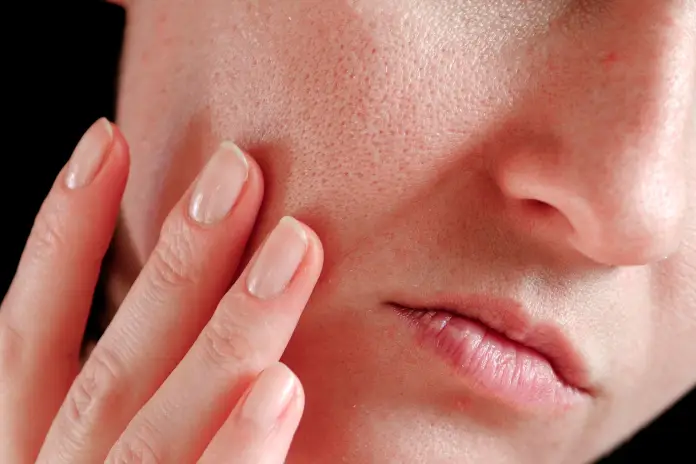 Закупорка пор: как очистить лицо в домашних условиях