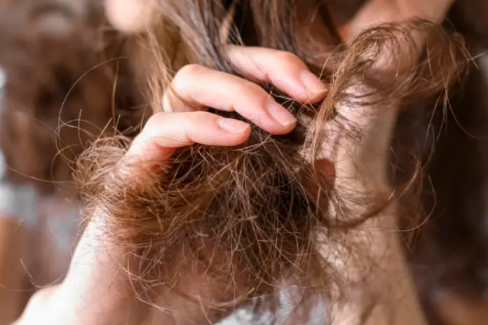 Сухость кожи головы: как вернуть здоровье и красоту волос