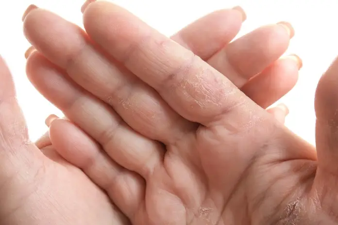 Красота прикосновений: как победить сухость кожи рук и ног