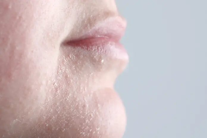 Сухость кожи лица: как вернуть мягкость, сияние и комфорт после 50